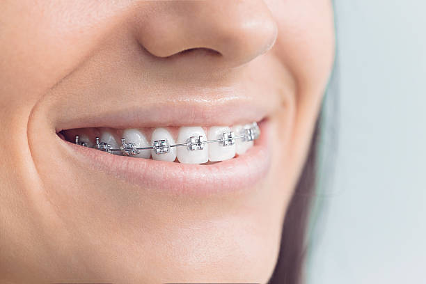 Best Traditional Braces  in Madison, WV